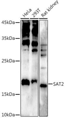 Western Blot: SAT2 Antibody [NBP3-04471] - Western blot analysis of extracts of various cell lines, using (NBP3-04471) at 1:500 dilution. Secondary antibody: HRP Goat Anti-Rabbit IgG (H+L) at 1:10000 dilution. Lysates/proteins: 25ug per lane. Blocking buffer: 3% nonfat dry milk in TBST. Detection: ECL Enhanced Kit. Exposure time: 90s.